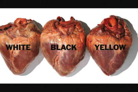 Oliviero Toscani